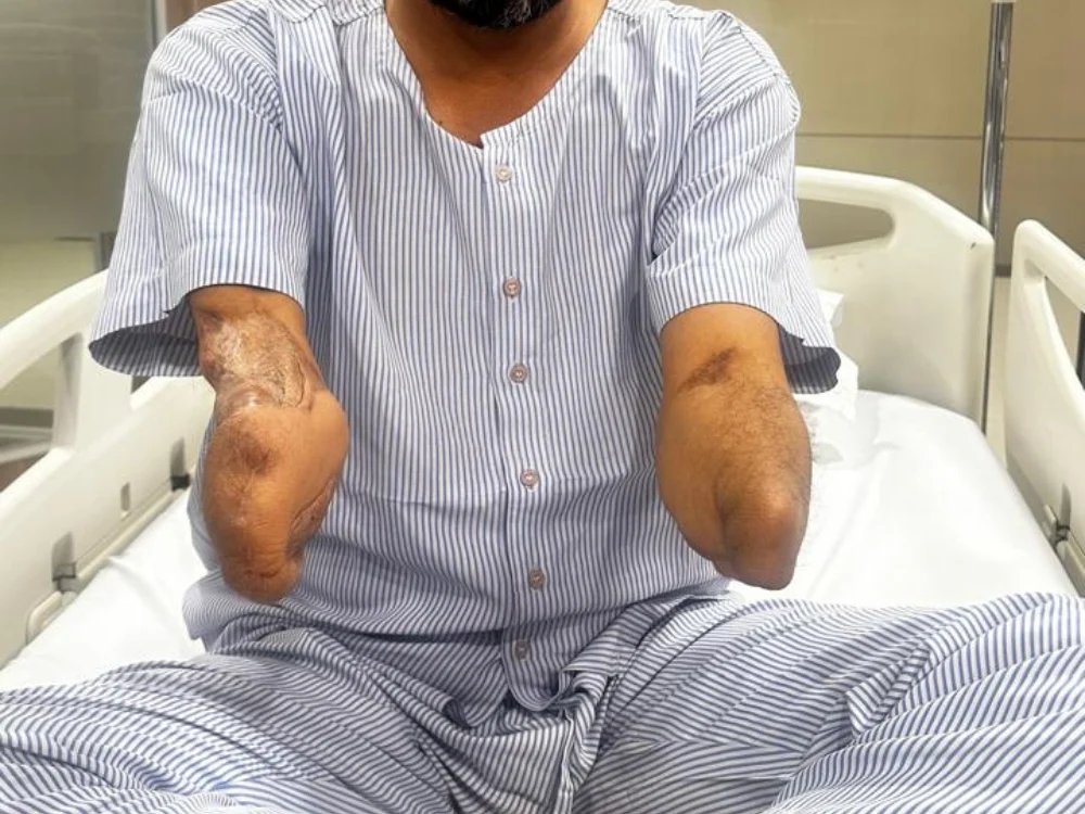 Before reconstructive surgery in Surat