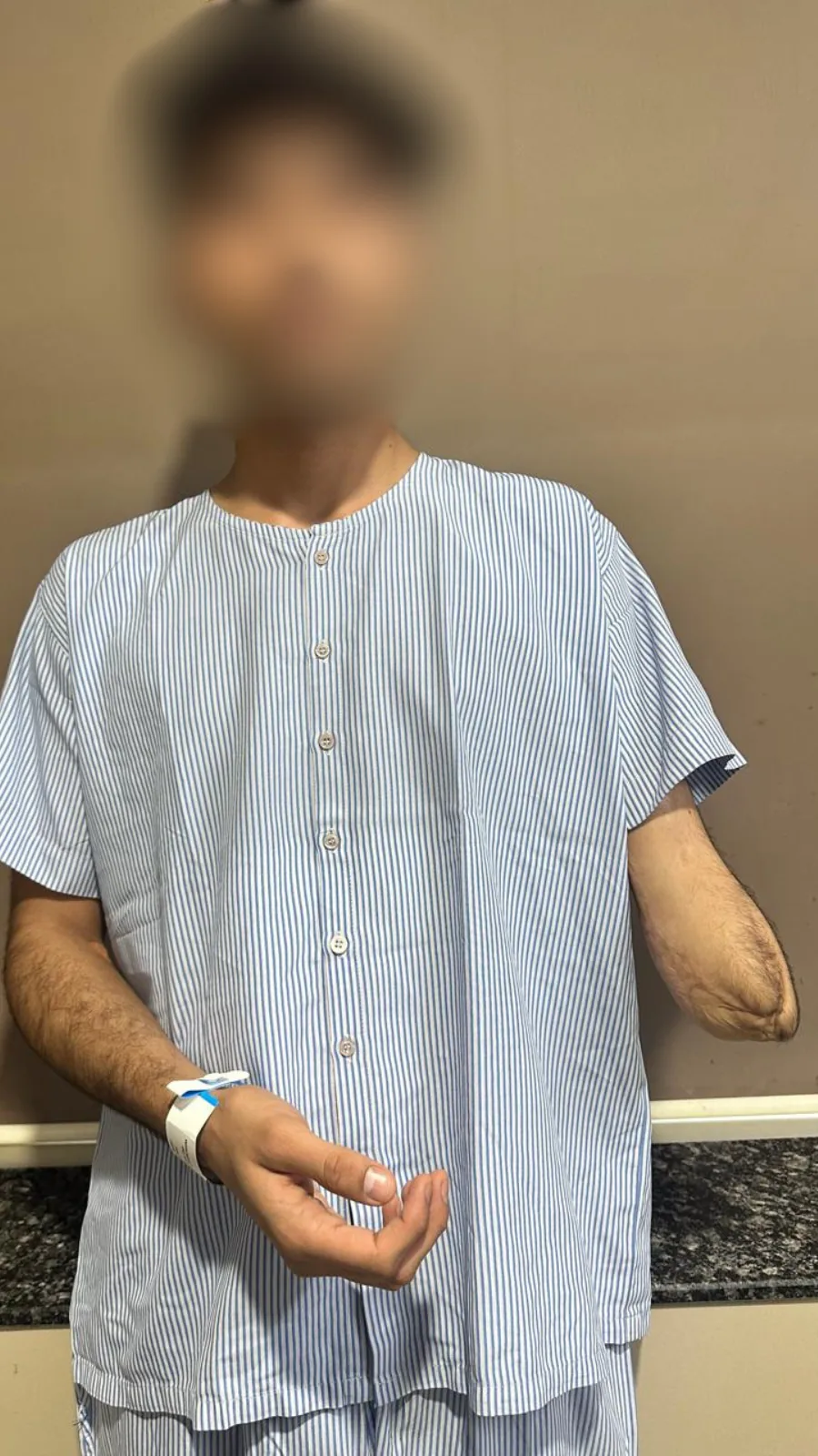 A hand transplant patient on the ward at Kiran Hospital, Surat