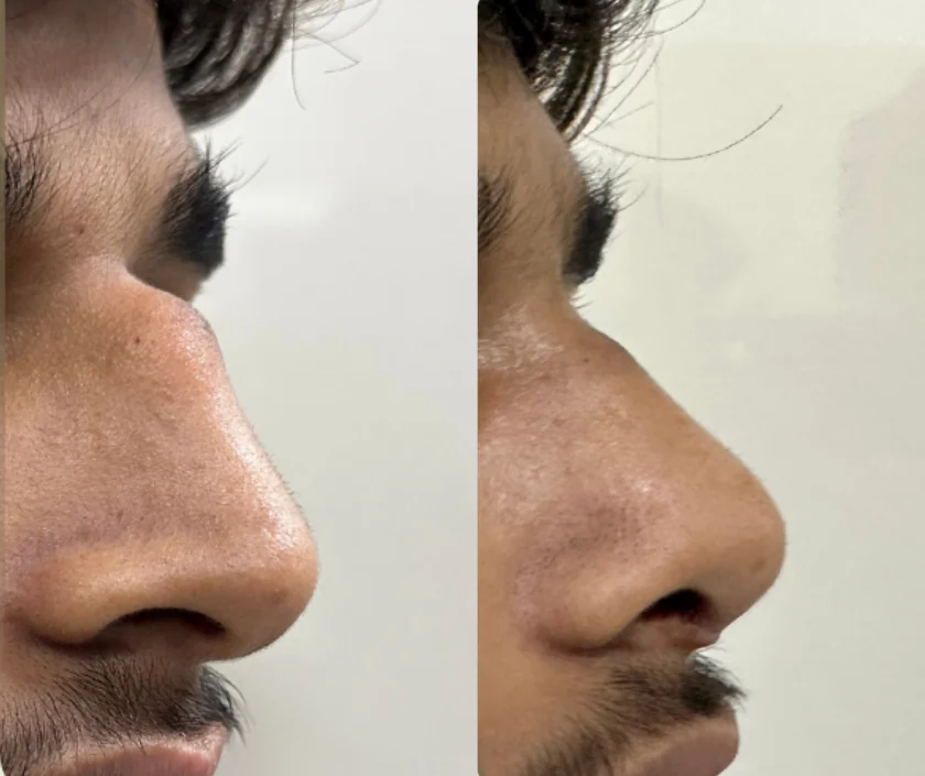Cosmetic and aesthetic surgery in Surat